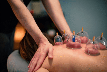 woman taking cupping treatment