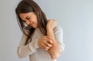 Acupuncture for Eczema