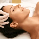 Acupuncture facelift. Facial acupuncture