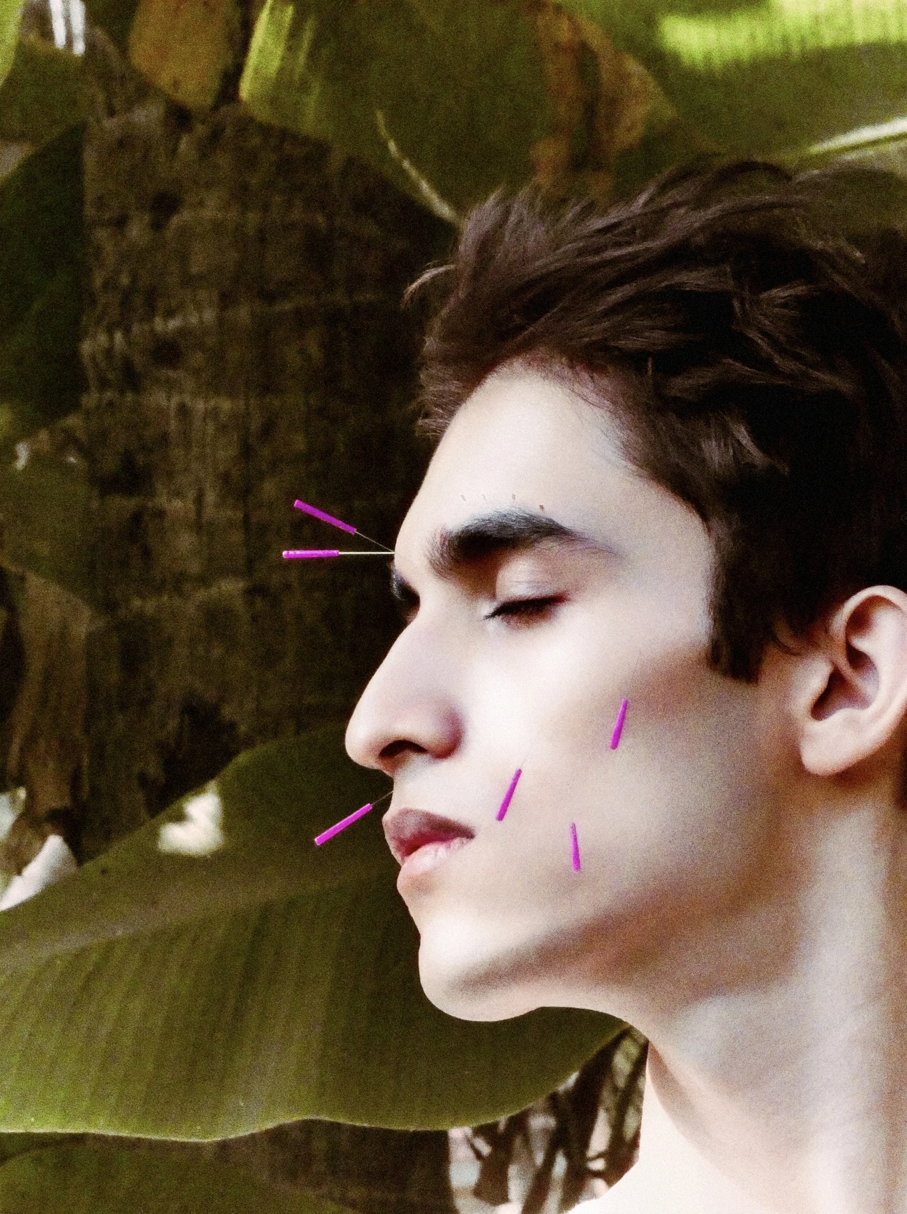 Practitioner performing facial acupuncture treatment on a patient