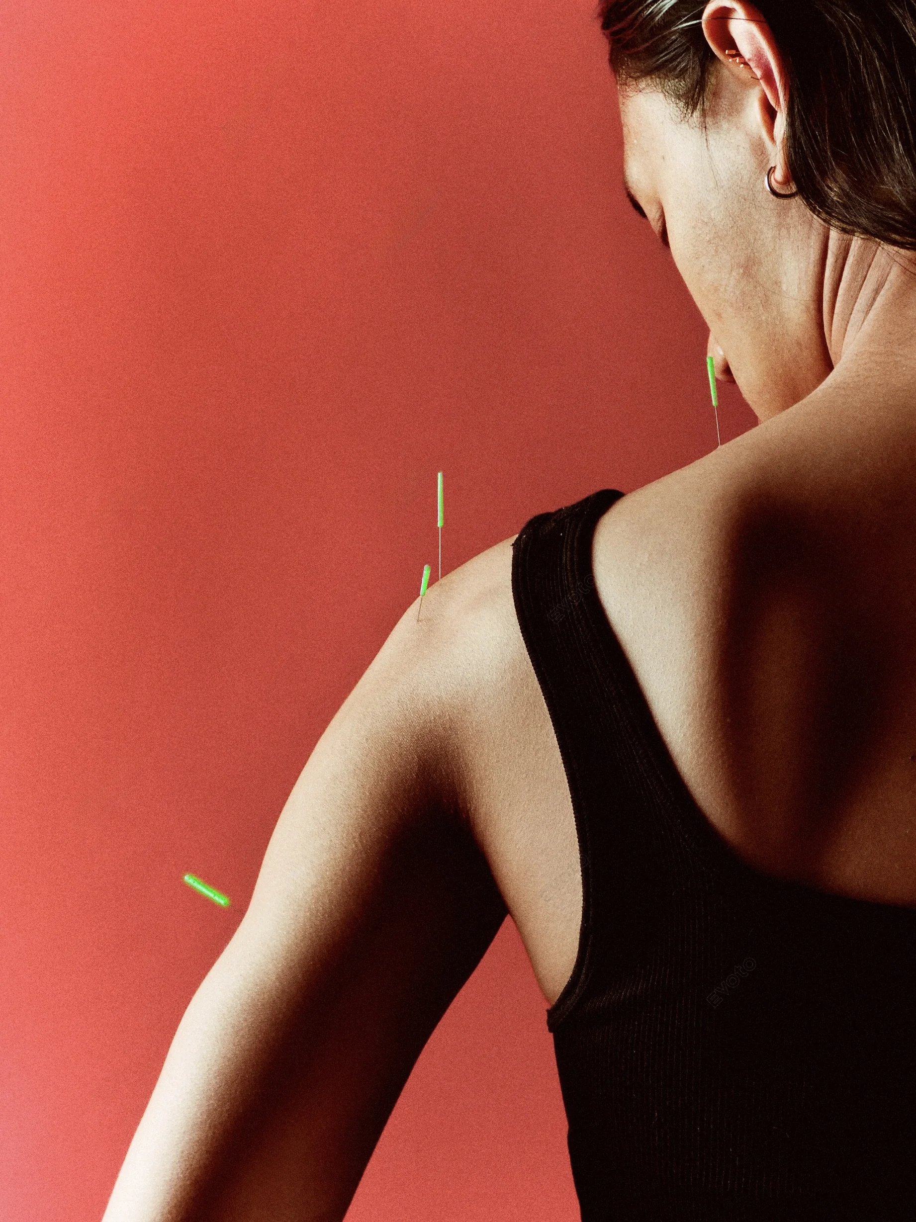 Acupuncture at Balancepoint