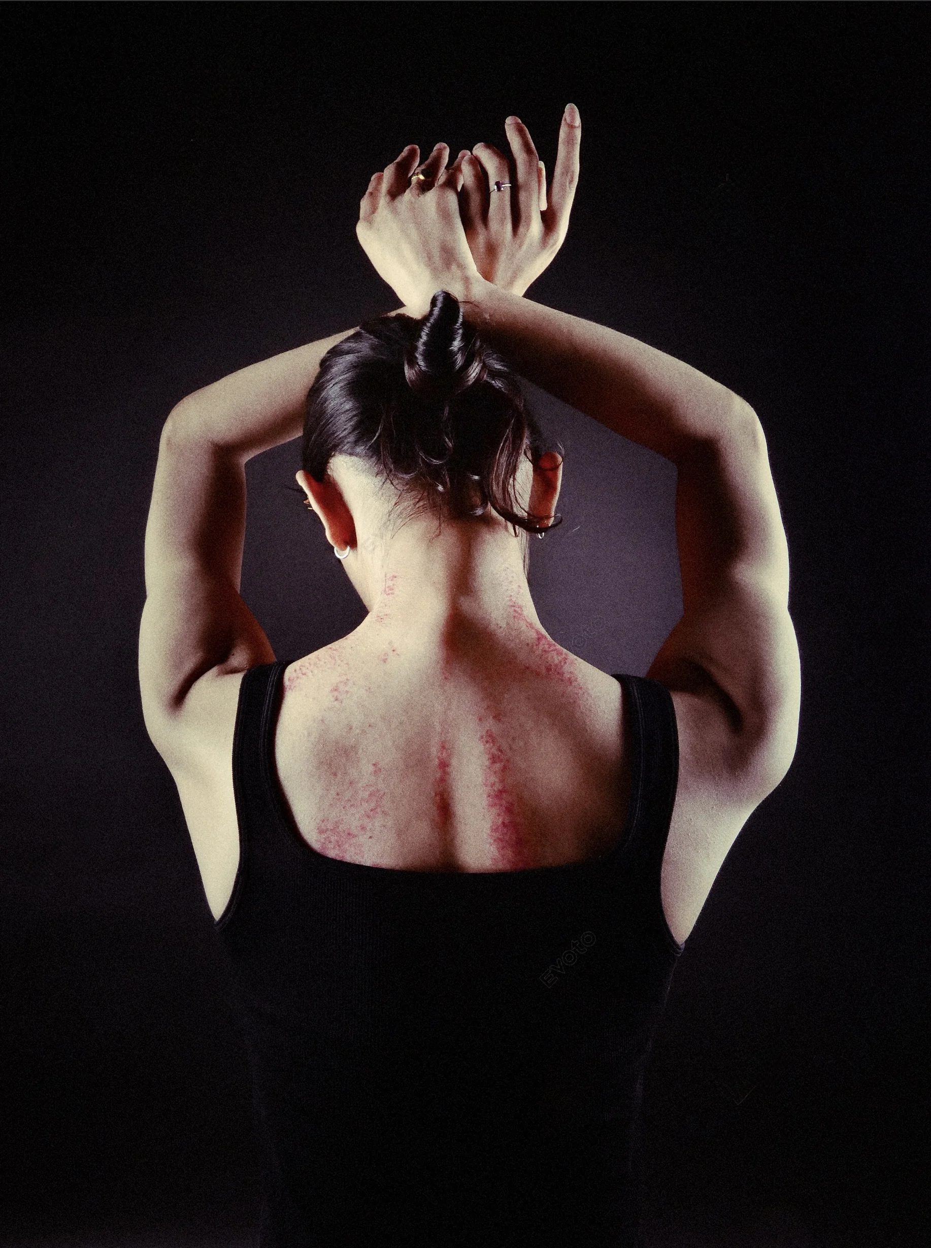 Gua sha therapy at Balancepoint Mumbai