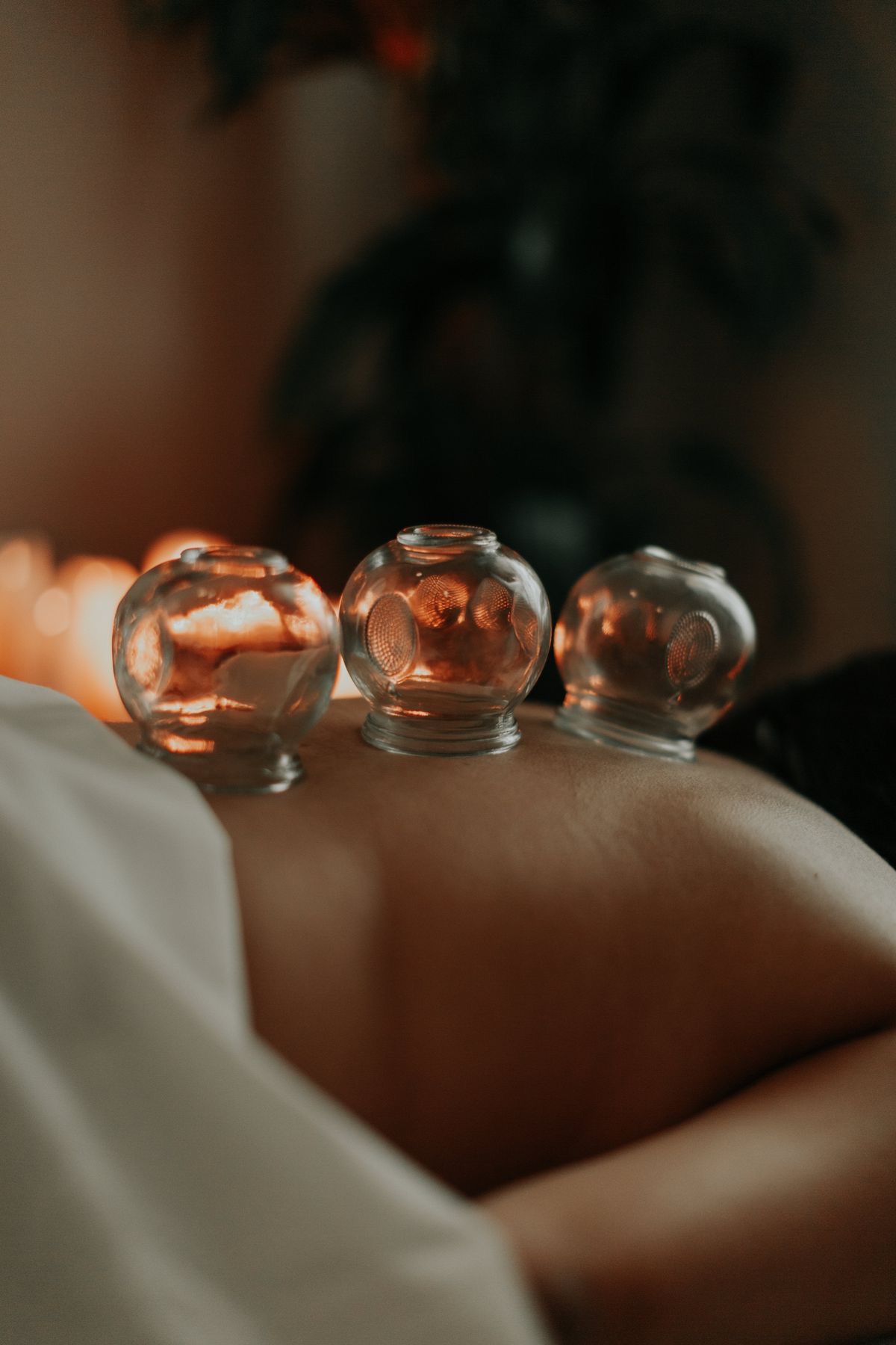 Pain management acupuncture at Balancepoint