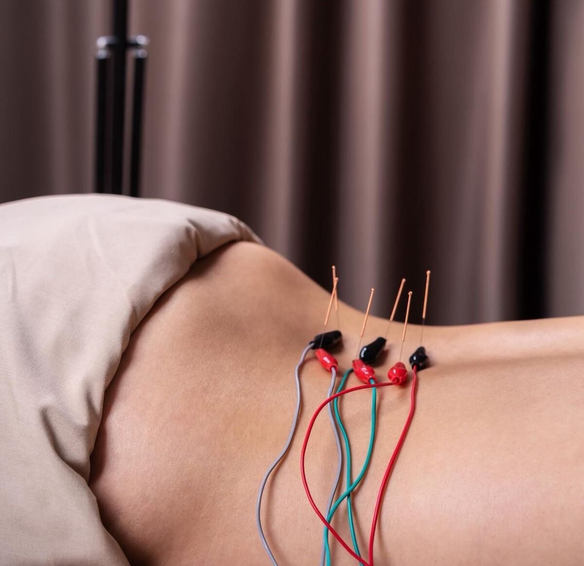 Electro acupuncture at Balancepoint Mumbai