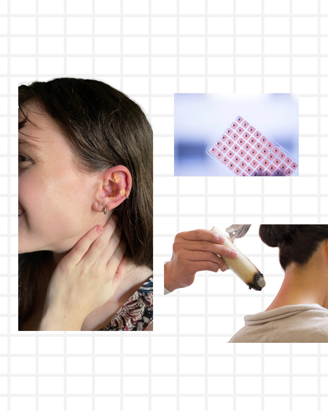 Moxibustion stick being used during a TCM treatment session