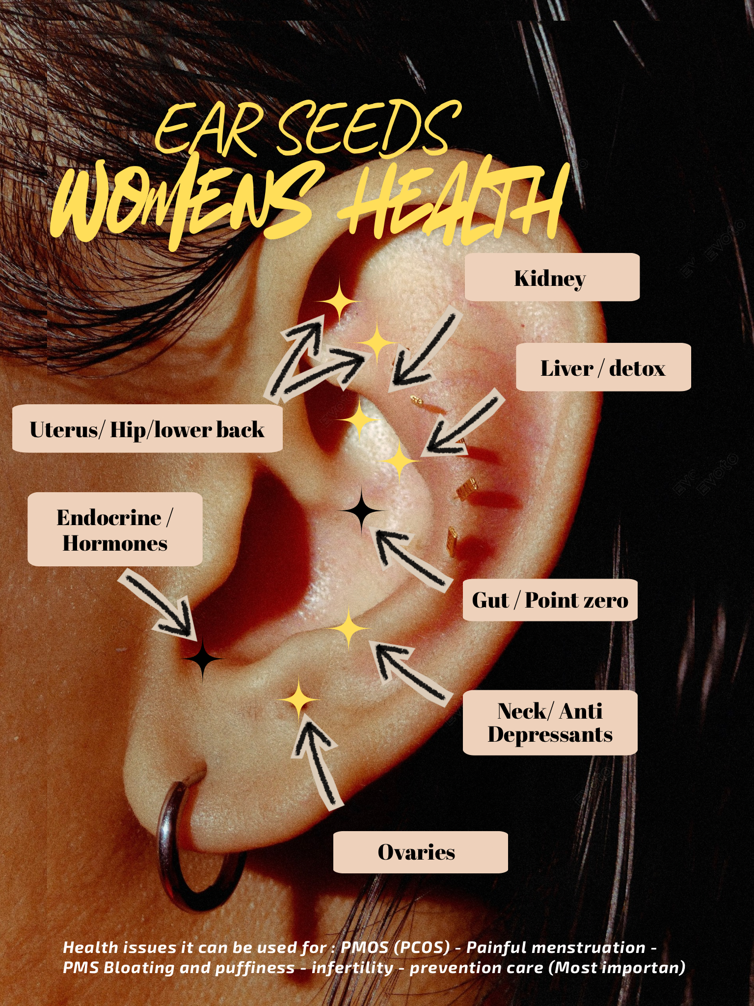 Detailed auriculotherapy ear chart showing acupuncture points for the entire body